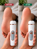 Soleva Electric Foot File